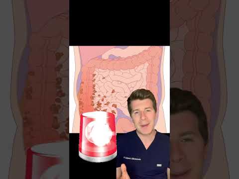 Navigating the Pain of Appendix Hurt in Tech Life