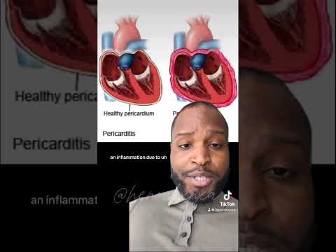Revolutionizing Heart Health: Innovations in Pericarditis Care