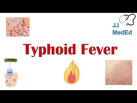 Typhoid Disease: Innovations in Prevention and Treatment