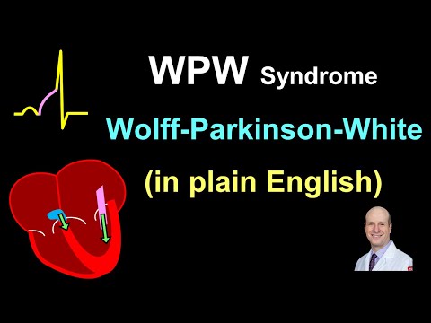 Harnessing Technology for Effective Wolf Parkinson White Solutions