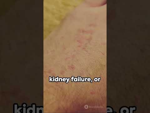 Revitalize Health with Furosemide Technology Solutions