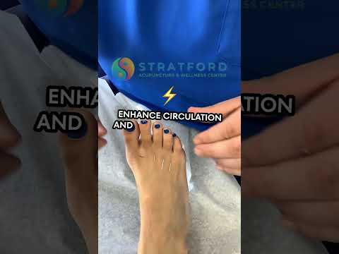 Revitalize Your Wellness with Smart Acupuncture Pads