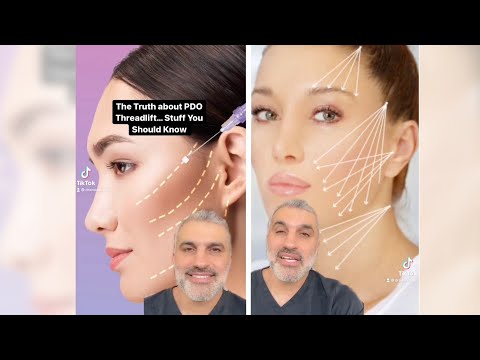 Revitalize Your Look with Innovative Thread Face Lift Technology