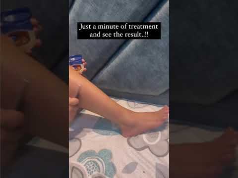 Unlocking the Mystery Behind Swollen Foot Causes Today