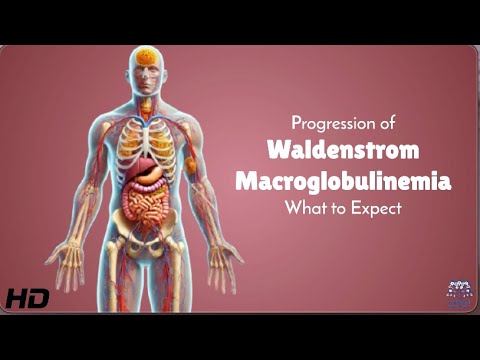 Innovative Solutions for Waldenstrom Macroglobulinemia Management