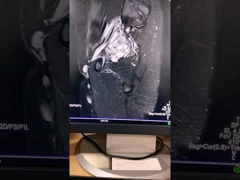 Revolutionizing Healthcare with Advanced Pelvic MRI Technology