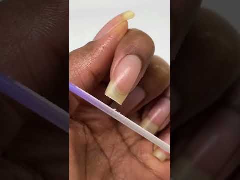 Strengthen Your Brittle Nails with Smart Solutions Today