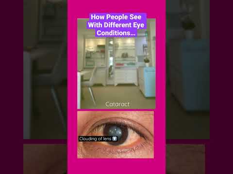 Spotting Diabetic Retinopathy Symptoms with Smart Tech Solutions