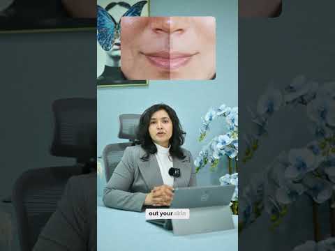 Laser Resurfacing Cost: Get Your Glow Without Breaking the Bank