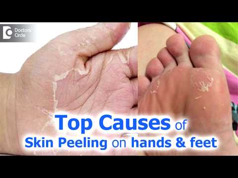 Revitalize Your Skin with Innovative Feet Peeling Solutions