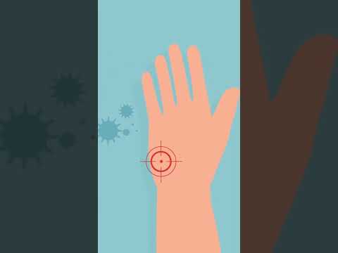 Recognize Tetanus Symptoms Before It's Too Late