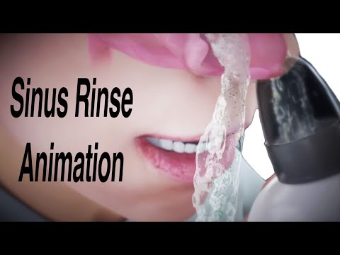 Revolutionize Your Health Routine with Nasal Irrigation Solutions