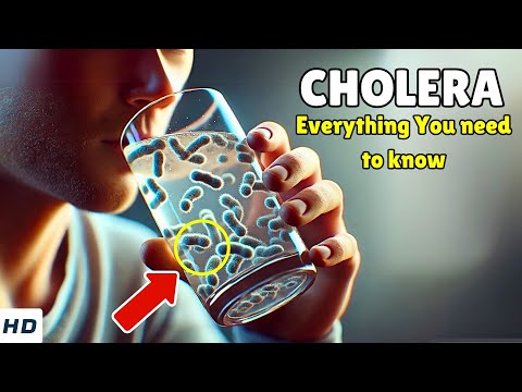 Stay Alert: Key Signs of Cholera You Shouldn't Ignore