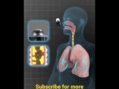 Breathe Freely with Fluticasone Propionate Inhaler Technology
