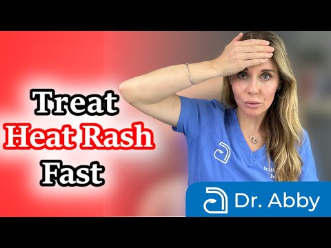 Beat Heat Rash: Tech Solutions for Adult Skin Comfort