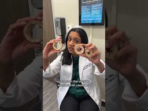 Breathe Easy: Tech Solutions for Activity Induced Asthma