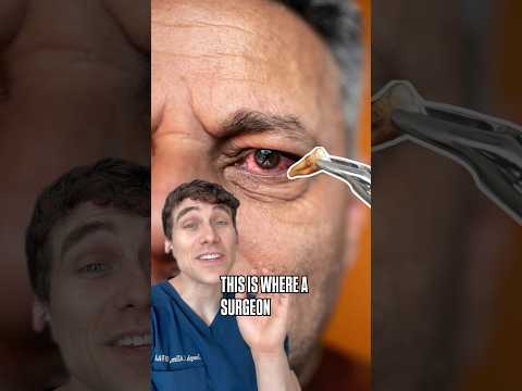 Revolutionizing Eye Surgery with Innovative Tooth Technology