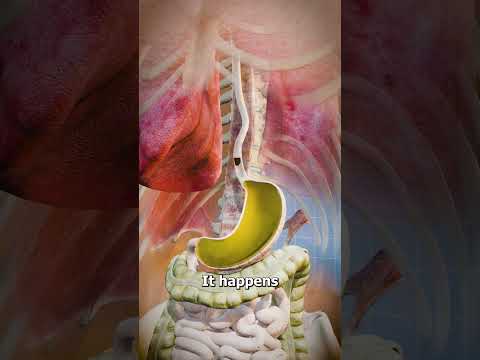 Unveiling the Tech Behind Gastric Reflux Triggers