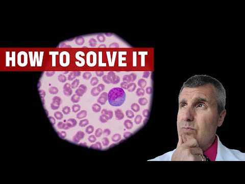 Unlocking Relief: Managing Lymphocytic Colitis Symptoms