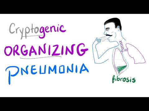 Navigating Organizing Pneumonia: Tech Solutions and Marketing Insights