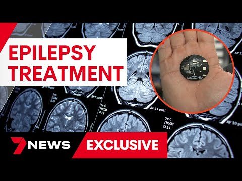Revolutionizing Epilepsy Treatment with Innovative Technology