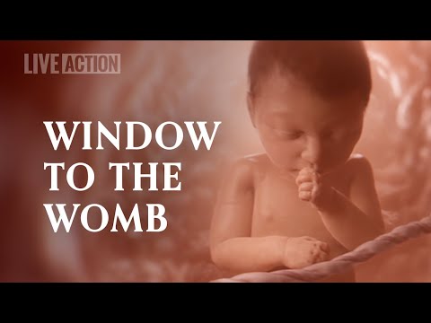 Capture Your Baby's First Moments with 9 Week Ultrasound