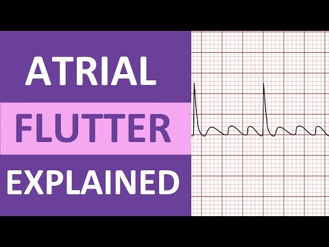 Revolutionizing Heart Health with Atrial Flutter ECG Tech
