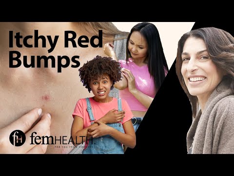 Red Bumps on Skin? Uncover Solutions with Tech Innovations