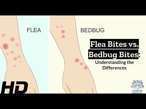 Beat Bed Bug Bites – Relief for Itchy Nights Awaits