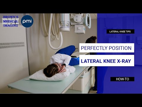 Knee X-Ray Revolution: Precision Imaging for Better Care