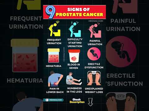 Uncovering Insights on Foul Smelling Urine and Cancer Risks