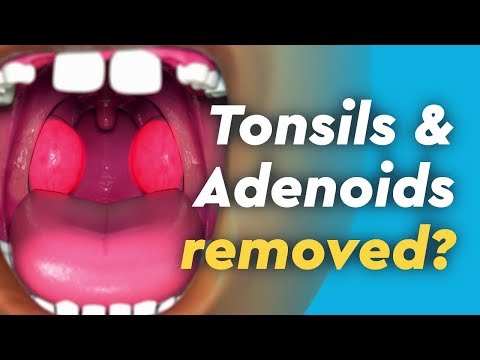 Revolutionize Breathing: The Future of Adenoid Removal