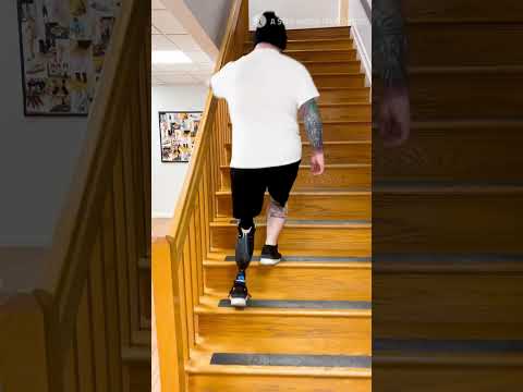 Revolutionizing Mobility: The Promise of Rotationplasty