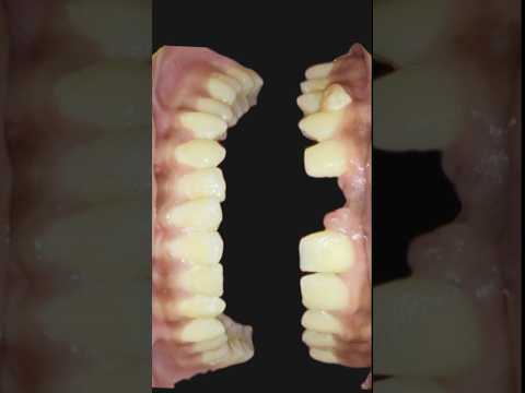 Revolutionize Your Smile with Cutting-Edge Dental X Rays