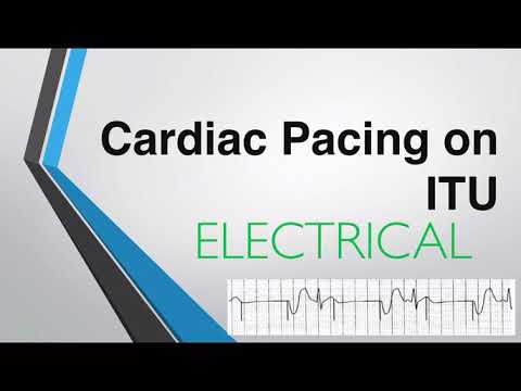 Transcutaneous Pacing: Revolutionizing Heart Care Technology