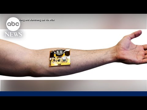 Smart Bandages Revolutionizing Healing and Care Technology