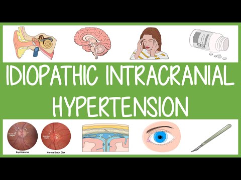 Revolutionizing Intracranial Hypertension Treatment with Tech