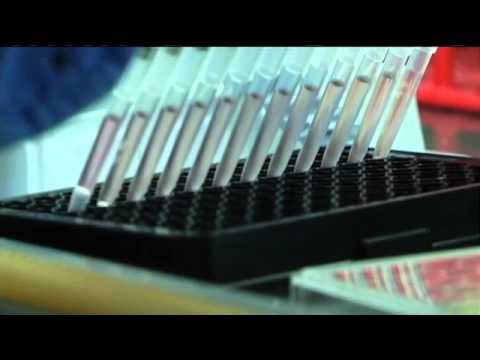 Transforming MDS Cancer Care with Cutting-Edge Technology