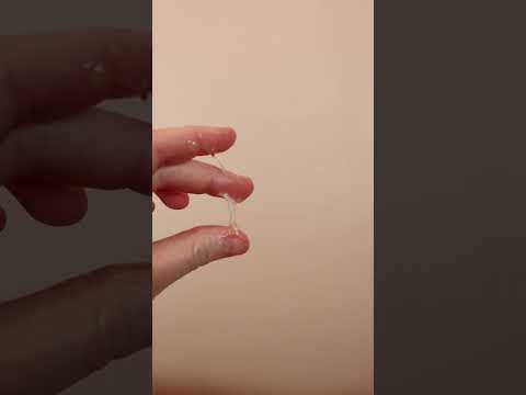 Understanding Pregnancy Discharge After Ovulation