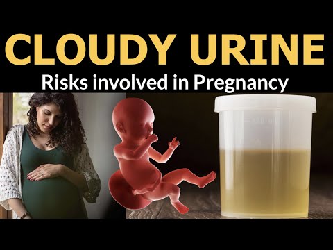 Cloudy Urine During Pregnancy: Tech Insights for Moms-to-Be