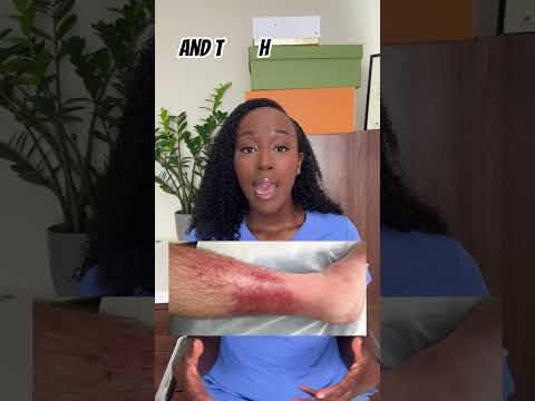 Facial Cellulitis Uncovered: Tech Solutions for Skin Health