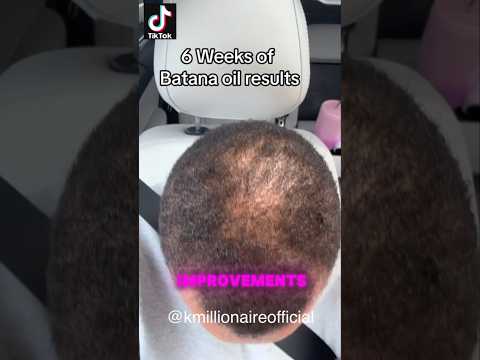 Revive and Thrive: Cutting-Edge Solutions for Thinning Hair