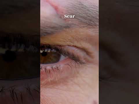 Serrapeptase Revolutionizes Pain Relief with Smart Tech Solutions