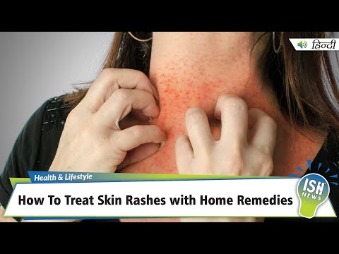Rash Rundown: Unveiling Skin Solutions in a Tech World