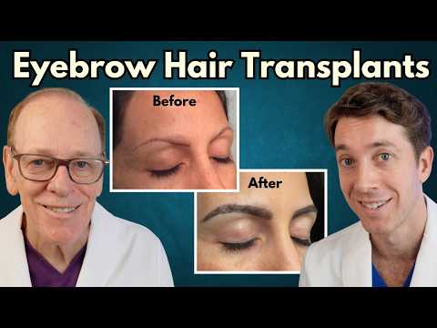 Revive Your Look with Innovative Eyebrow Transplants
