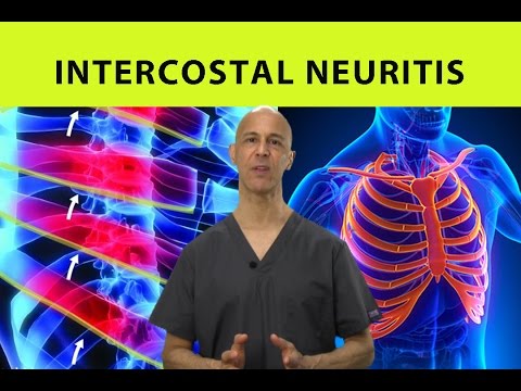 Relieve Your Left Side Rib Pain with Smart Solutions Today