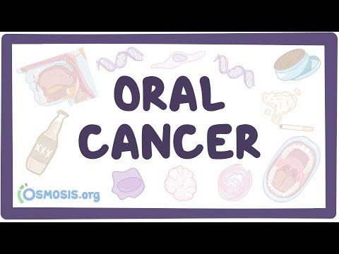Innovative Solutions in Tongue Cancer Diagnosis and Treatment