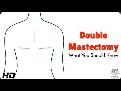 Empowering Women Through Advanced Double Mastectomy Solutions