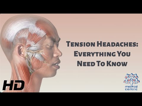 Unraveling What Triggers Tension Headaches Today