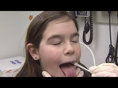 Strep Throat Symptoms: Uncovering Tongue Insights and Tech Solutions